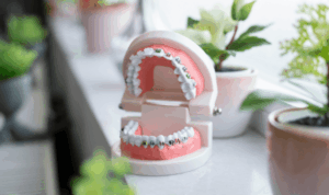 矯正 歯科 集客